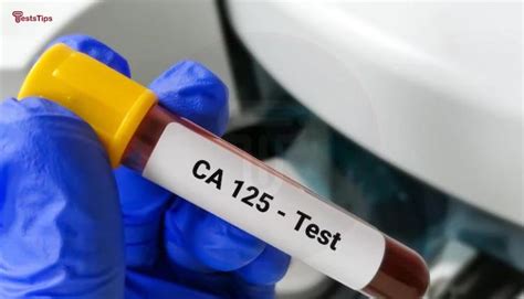 ca 125 blood test bottle colour|ca 125 levels explained uk.